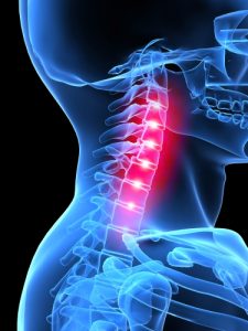 neck-pain physio